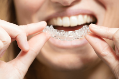 Ortodonzia invisibile
