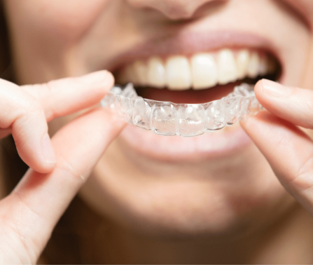 Ortodonzia invisibile