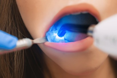 Odontoiatria conservativa