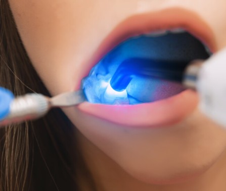 Odontoiatria conservativa